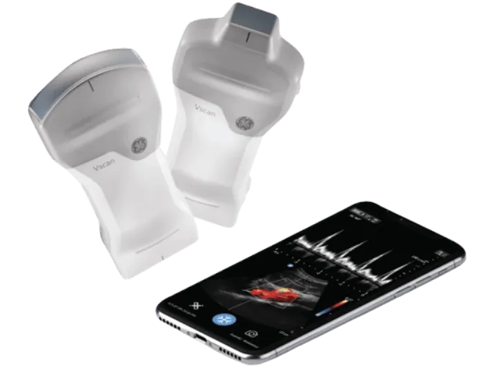 Handheld Ultrasound